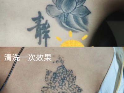 曹县洗纹身一般要多少次图1