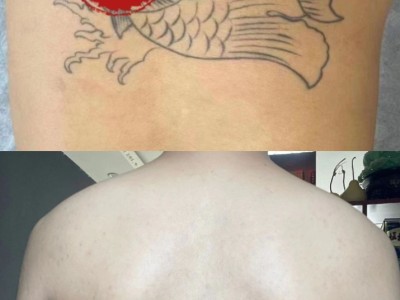 曹县比较好的纹身店专业洗纹身图1