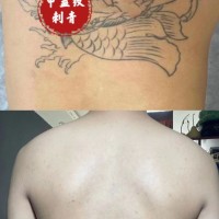 曹县比较好的纹身店专业洗纹身