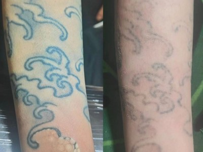 曹县比较好的纹身店专业洗纹身图3
