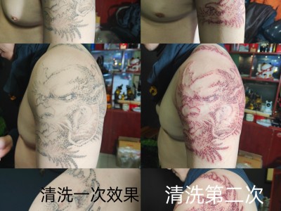 曹县比较好的纹身店专业洗纹身图2