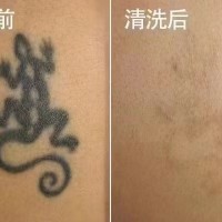 曹县纹身设计旧图遮盖清洗纹身