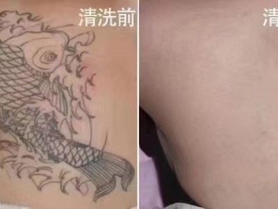 曹县纹身设计旧图遮盖清洗纹身图2