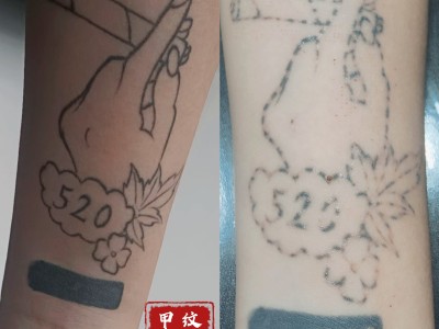 曹县纹身设计旧图遮盖清洗纹身图3